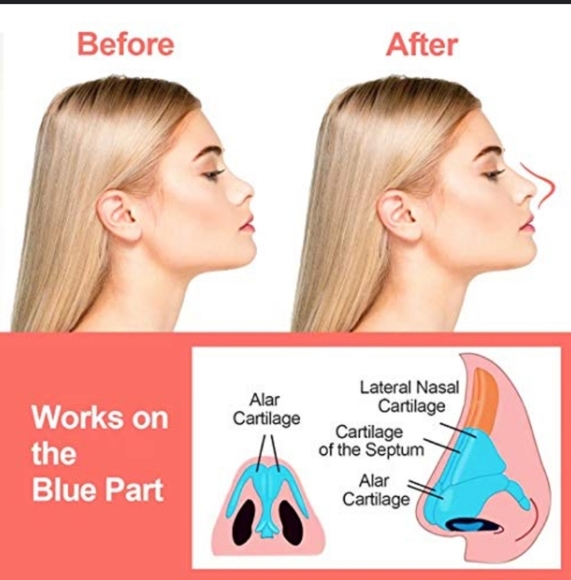 Nose device 👃 - Picture 3 of 6